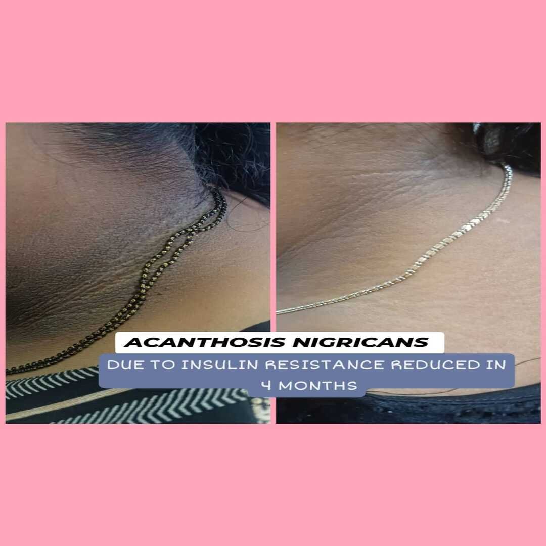 Top Thyroid Dieticians in Andheri East